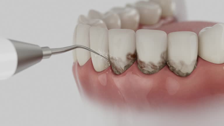 Reliable Dental Implants contractor in Eldora, IA by Smile Center Dentistry
